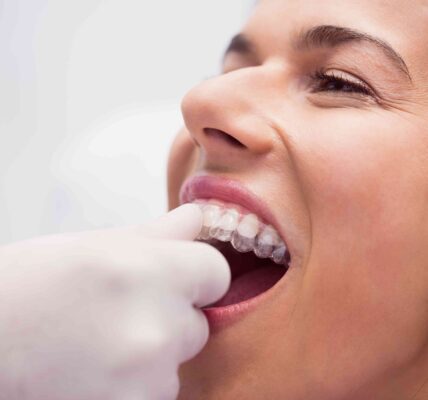 Invisalign