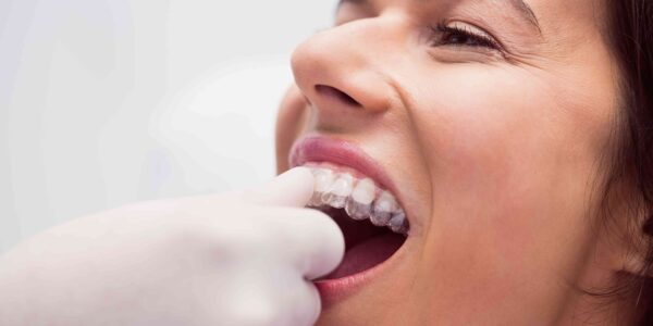 Invisalign